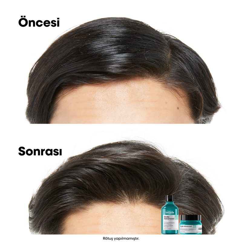 Scalp Advanced Yağlanma Karşıtı Profesyonel Şampuan - Görsel 5