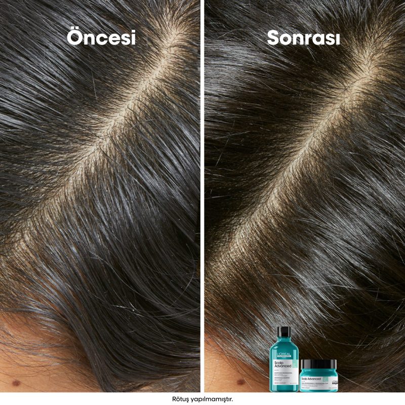 Scalp Advanced Yağlanma Karşıtı Profesyonel Şampuan - Görsel 4